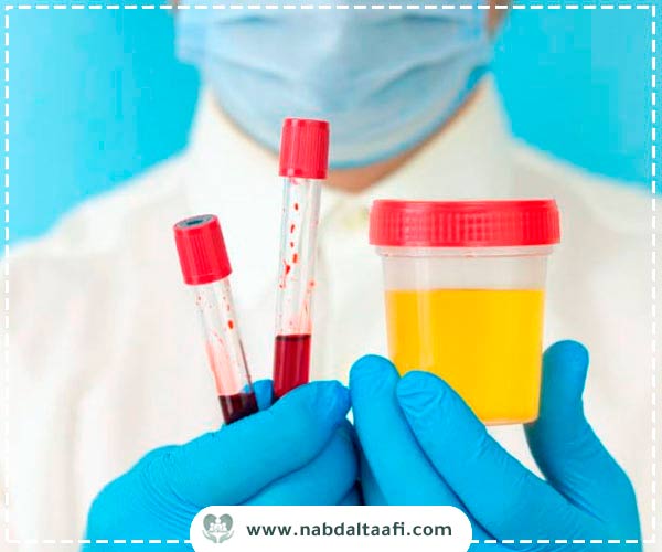 تقليل مدة بقاء الكبتاجون في الجسم في مستشفى نبض التعافي