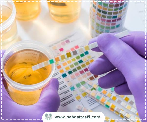 مدة بقاء الكبتاجون في الجسم للمتعاطي لأول مرة